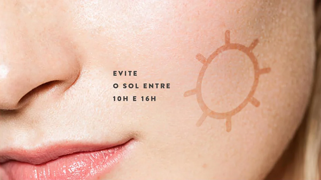 Adcos. Prevenção do Câncer da Pele.