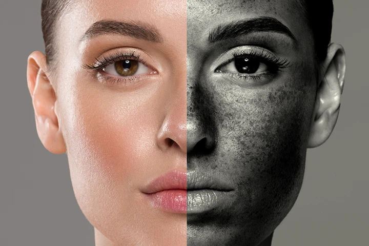 Adcos. Prevenção Câncer de Pele.